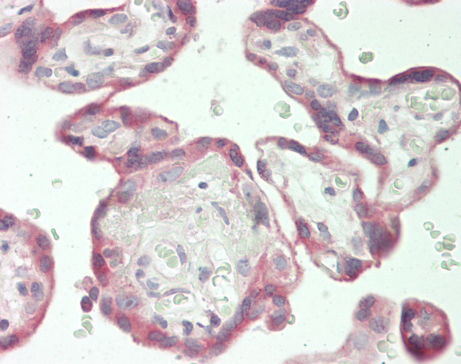 Human Placenta: Formalin-Fixed, Paraffin-Embedded (FFPE)