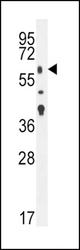 TGFBR2 Antibody western blot of mouse lung tissue lysates (35 ug/lane). The TGFBR2 antibody detected the TGFBR2 protein (arrow).