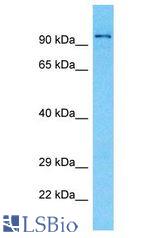 TGFBRAP1 / TRAP-1 antibody Western Blot of Fetal Kidney. Antibody dilution: 1 ug/ml.
