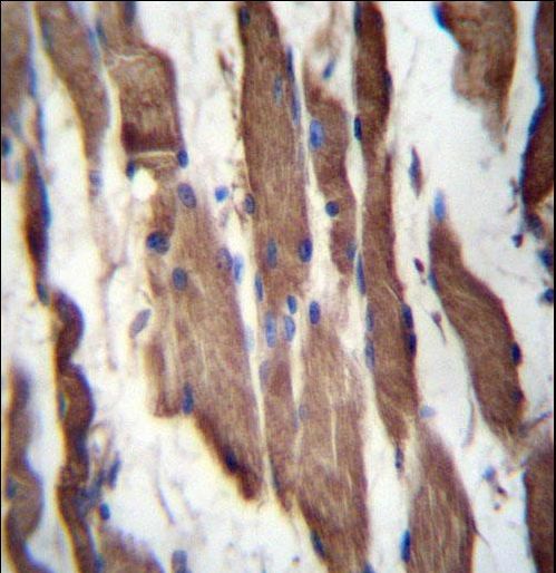TGFBRAP1 Antibody immunohistochemistry of formalin-fixed and paraffin-embedded human skeletal muscle followed by peroxidase-conjugated secondary antibody and DAB staining.