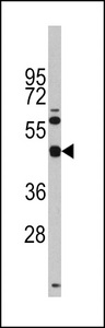 Western blot of anti-TGIF1 Antibody (Center L223) (RB14109) in Y79 cell line lysates (35 ug/lane). TGIF1(arrow) was detected using the purified antibody.
