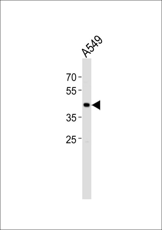 Western blot of lysate from A549 cell line, using TGIF1 Antibody. Antibody was diluted at 1:1000. A goat anti-rabbit IgG H&L (HRP) at 1:5000 dilution was used as the secondary antibody. Lysate at 35ug.