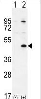 Western blot of TGIF1 (arrow) using rabbit polyclonal TGIF1 Antibody (Center L223). 293 cell lysates (2 ug/lane) either nontransfected (Lane 1) or transiently transfected (Lane 2) with the TGIF1 gene.