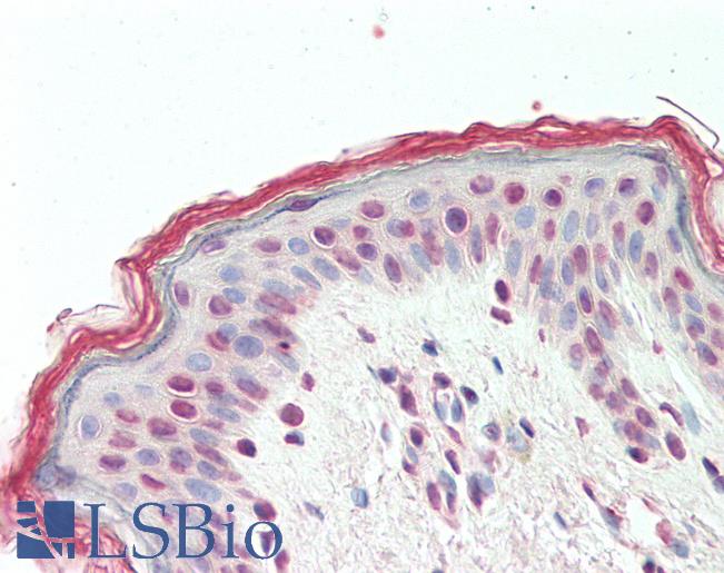 Anti-TGIF2 antibody IHC staining of human skin. Immunohistochemistry of formalin-fixed, paraffin-embedded tissue after heat-induced antigen retrieval. Antibody LS-B11170 concentration 5 ug/ml.