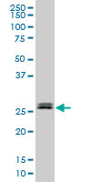 TGIF2 monoclonal antibody (M18), clone 2F3. Western blot of TGIF2 expression in HeLa NE.