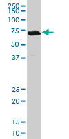 TGIF2 monoclonal antibody (M20), clone 2F5. Western blot of TGIF2 expression in Jurkat.