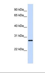 Hela cell lysate. Antibody concentration: 1.0 ug/ml. Gel concentration: 12%.