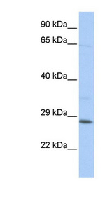 TGIF2LX antibody LS-C110125 Western blot of Jurkat lysate.
