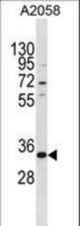 TGIF2LX Antibody western blot of A2058 cell line lysates (35 ug/lane). The TGIF2LX antibody detected the TGIF2LX protein (arrow).