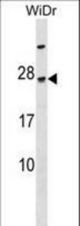 TGIF2LY Antibody western blot of WiDr cell line lysates (35 ug/lane). The TGIF2LY Antibody detected the TGIF2LY protein (arrow).