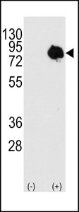 Western blot of TGM2 (arrow) using rabbit polyclonal TGM2 Antibody (Center T428). 293 cell lysates (2 ug/lane) either nontransfected (c) or transiently transfected with the TGM2 gene (Lane 2) (Origene Technologies).