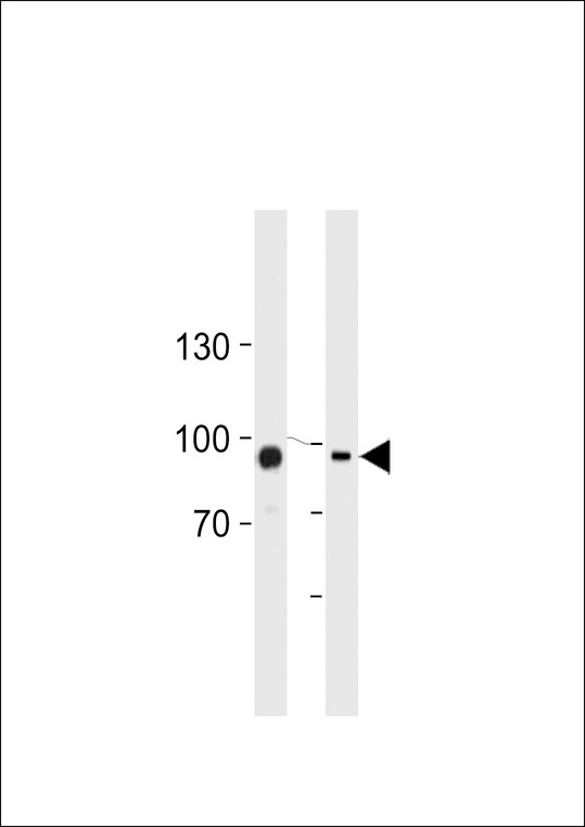 TGM2 Antibody (Center K444) western blot of HUVEC,K562 cell line lysates (35 ug/lane). The TGM2 antibody detected the TGM2 protein (arrow).