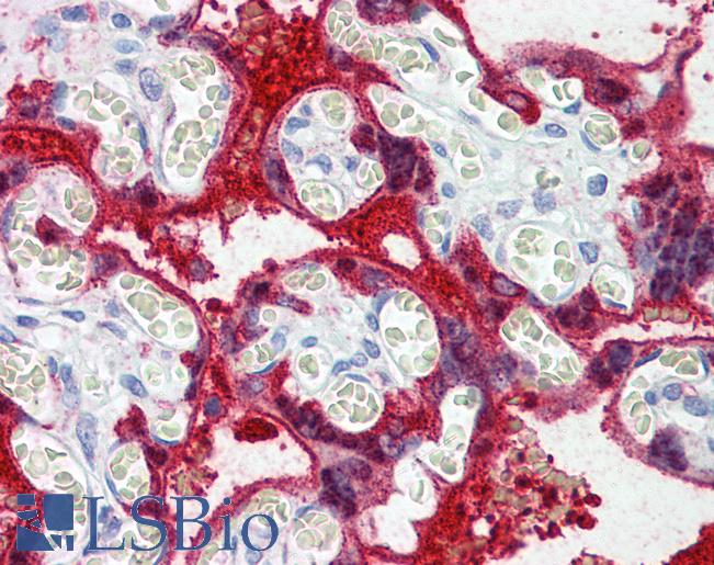 Anti-TGM2 / Transglutaminase 2 antibody IHC of human placenta. Immunohistochemistry of formalin-fixed, paraffin-embedded tissue after heat-induced antigen retrieval. Antibody LS-B5802 concentration 5 ug/ml.