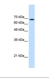 HepG2 cell lysate. Antibody concentration: 0.25 ug/ml. Gel concentration: 12%.