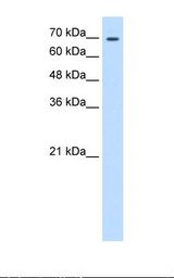 HepG2 cell lysate. Antibody concentration: 0.5 ug/ml. Gel concentration: 12%.