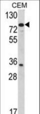 Western blot of TGM4 Antibody in CEM cell line lysates (35 ug/lane). TGM4 (arrow) was detected using the purified antibody.
