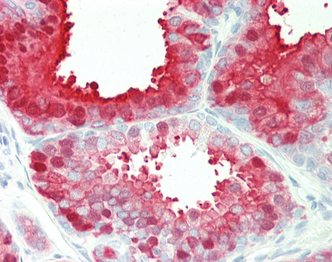 Human Prostate: Formalin-Fixed, Paraffin-Embedded (FFPE)