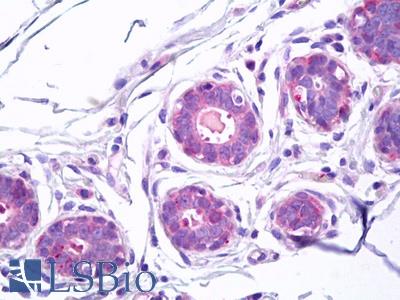 Anti-Transglutaminase 5 antibody IHC of human breast. Immunohistochemistry of formalin-fixed, paraffin-embedded tissue after heat-induced antigen retrieval. Antibody LS-B7525 concentration 10 ug/ml.