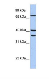 Hela cell lysate. Antibody concentration: 1.0 ug/ml. Gel concentration: 12%.