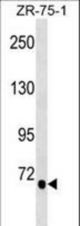 TGM5 Antibody western blot of ZR-75-1 cell line lysates (35 ug/lane). The TGM5 antibody detected the TGM5 protein (arrow).