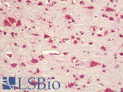 Anti-TGM7 / Transglutaminase 7 antibody IHC staining of human brain, cortex. Immunohistochemistry of formalin-fixed, paraffin-embedded tissue after heat-induced antigen retrieval. Antibody LS-B9576 concentration 5 ug/ml.