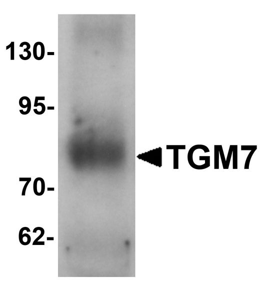 Western blot analysis of TGM7 in human lung tissue lysate with TGM7 antibody at 1 ug/ml.