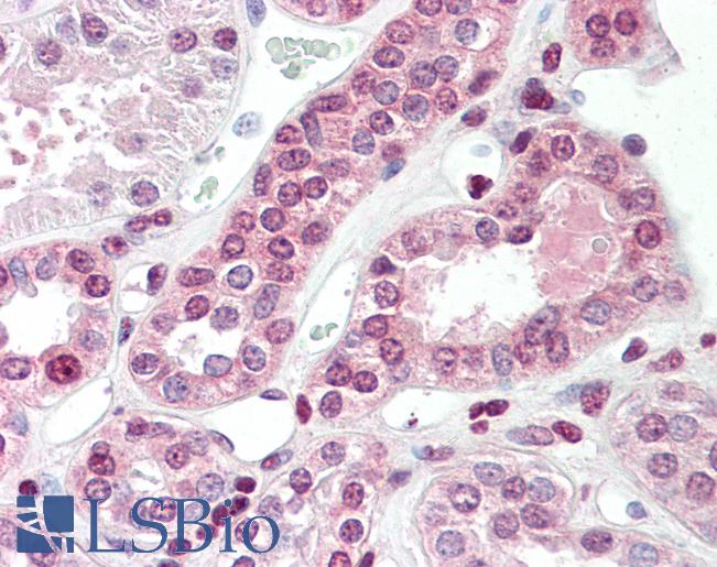 Anti-TGM7 / Transglutaminase 7 antibody IHC staining of human kidney. Immunohistochemistry of formalin-fixed, paraffin-embedded tissue after heat-induced antigen retrieval. Antibody LS-B9533 concentration 5 ug/ml.
