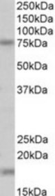 TGM7 antibody (0.1 ug/ml) staining of Mouse Kidney lysate (35 ug protein/ml in RIPA buffer). Primary incubation was 1 hour. Detected by chemiluminescence.