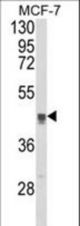 Western blot of TGOLN2 Antibody in MCF-7 cell line lysates (35 ug/lane). TGOLN2 (arrow) was detected using the purified antibody.