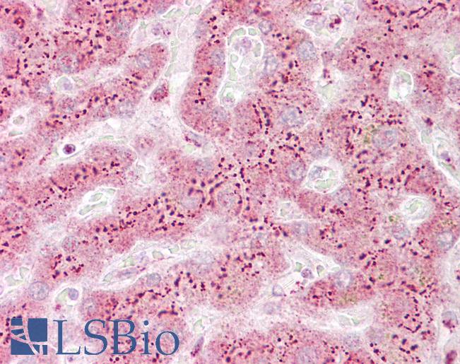 Anti-TGOLN2 / TGN46 antibody IHC of human liver. Immunohistochemistry of formalin-fixed, paraffin-embedded tissue after heat-induced antigen retrieval. Antibody LS-B6842 concentration 5 ug/ml.