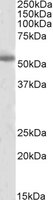 TH antibody (2 ug/ml) staining of Human Cerebral Cortex lysate (35 ug protein/ml in RIPA buffer). Primary incubation was 1 hour. Detected by chemiluminescence.