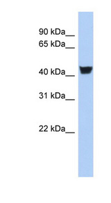 TH / Tyrosine Hydroxylase antibody LS-C112276 Western blot of Fetal Stomach lysate.