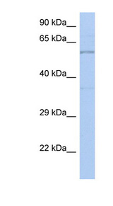 TH / Tyrosine Hydroxylase antibody LS-C109576 Western blot of Fetal Small Intestine lysate.