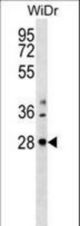 THAP10 Antibody western blot of WiDr cell line lysates (35 ug/lane). The THAP10 Antibody detected the THAP10 protein (arrow).