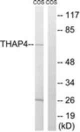 Western blot of extracts from COS7 cells, using THAP4 Antibody. The lane on the right is treated with the synthesized peptide.
