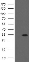 HEK293T cells were transfected with the pCMV6-ENTRY control (Left lane) or pCMV6-ENTRY THAP6 (Right lane) cDNA for 48 hrs and lysed. Equivalent amounts of cell lysates (5 ug per lane) were separated by SDS-PAGE and immunoblotted with anti-THAP6.