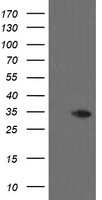 HEK293T cells were transfected with the pCMV6-ENTRY control (Left lane) or pCMV6-ENTRY THAP6 (Right lane) cDNA for 48 hrs and lysed. Equivalent amounts of cell lysates (5 ug per lane) were separated by SDS-PAGE and immunoblotted with anti-THAP6.