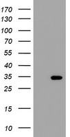 HEK293T cells were transfected with the pCMV6-ENTRY control (Left lane) or pCMV6-ENTRY THAP6 (Right lane) cDNA for 48 hrs and lysed. Equivalent amounts of cell lysates (5 ug per lane) were separated by SDS-PAGE and immunoblotted with anti-THAP6.