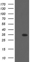 HEK293T cells were transfected with the pCMV6-ENTRY control (Left lane) or pCMV6-ENTRY THAP6 (Right lane) cDNA for 48 hrs and lysed. Equivalent amounts of cell lysates (5 ug per lane) were separated by SDS-PAGE and immunoblotted with anti-THAP6.