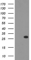 HEK293T cells were transfected with the pCMV6-ENTRY control (Left lane) or pCMV6-ENTRY THAP6 (Right lane) cDNA for 48 hrs and lysed. Equivalent amounts of cell lysates (5 ug per lane) were separated by SDS-PAGE and immunoblotted with anti-THAP6.