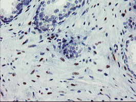 IHC of paraffin-embedded Human prostate tissue using anti-THAP6 mouse monoclonal antibody. (Heat-induced epitope retrieval by 10mM citric buffer, pH6.0, 100C for 10min).