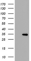 HEK293T cells were transfected with the pCMV6-ENTRY control (Left lane) or pCMV6-ENTRY THAP6 (Right lane) cDNA for 48 hrs and lysed. Equivalent amounts of cell lysates (5 ug per lane) were separated by SDS-PAGE and immunoblotted with anti-THAP6.