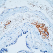 Formalin-fixed, paraffin-embedded human placenta stained with peroxidase-conjugate and AEC chromogen. Note staining of platelets in the blood vessels.