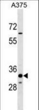 THEM5 Antibody western blot of A375 cell line lysates (35 ug/lane). The THEM5 antibody detected the THEM5 protein (arrow).