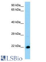 THEM6 / C8orf55 antibody Western Blot of Mouse Stomach. Antibody dilution: 1 ug/ml.