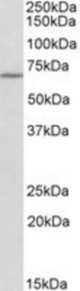 THEMIS antibody (0.3 ug/ml) staining of Mouse Spleen lysate (35 ug protein/ml in RIPA buffer). Primary incubation was 1 hour. Detected by chemiluminescence.
