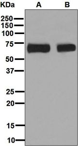 Western blot analysis on (A) Jurkat and (B) human thymus lysates using anti-THEMIS antibody.