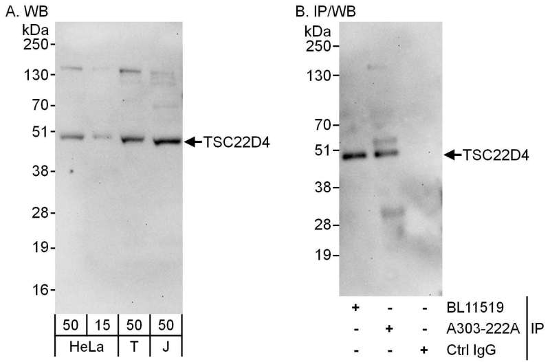 Detection of Human TSC22D4 by Western Blot. Samples: Whole cell lysate from HeLa (15 and 50 ug for WB; 1 mg for IP, 20% of IP loaded), 293T (T; 50 ug) and Jurkat (J; 50 ug) cells. Antibodies: Affinity purified rabbit anti-TSC22D4 antibody used for WB at 0.4 ug/ml (A) and 1 ug/ml (B) and used for IP at 6 ug/mg lysate. TSC22D4 was also immunoprecipitated by rabbit anti-TSC22D4 antibody BL11519, which recognizes an upstream epitope. Detection: Chemiluminescence with exposure times of 30 seconds (A and B).