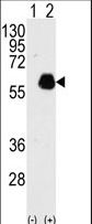 Western blot of PXN(arrow) using rabbit polyclonal PXN Antibody (Y118). 293 cell lysates (2 ug/lane) either nontransfected (Lane 1) or transiently transfected with PXN gene (Lane 2) (Origene Technologies).