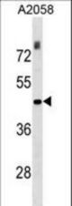 THOC3 Antibody western blot of A2058 cell line lysates (35 ug/lane). The THOC3 antibody detected the THOC3 protein (arrow).